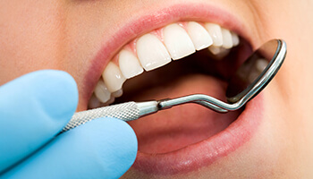 Close up of dental mirror examining teeth