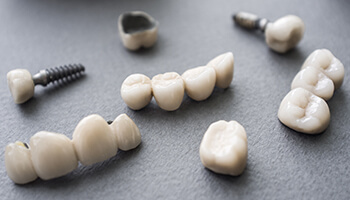 Several dental crowns and bridges attached to dental implants in Danville