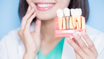 Osseointegration is the process of your dental implant fusing with your jawbone
