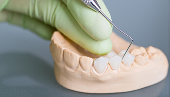 Dentist examining model of fixed bridge