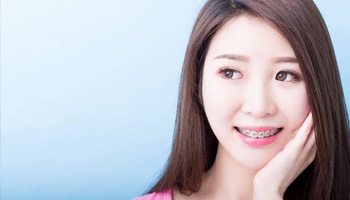 Woman with braces resting her chin in her hand and looking off into distance