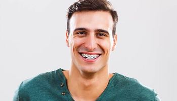 Young adult man with braces smiling