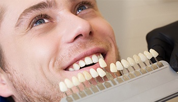 Man smile with dental crown color matching chart