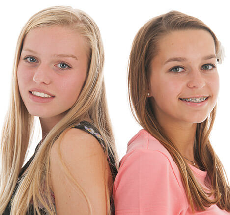 Young girl with braces standing back to back with a young girl with clear aligners