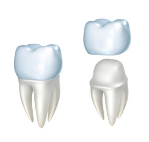 Close-up image of dental crown
