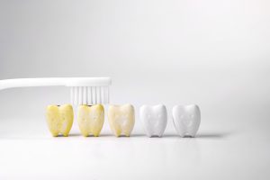 5 models of teeth on a white background in various stages of staining in front of white background